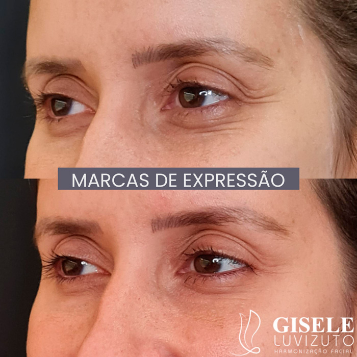 dra-gisele-luvizuto-expressao2
