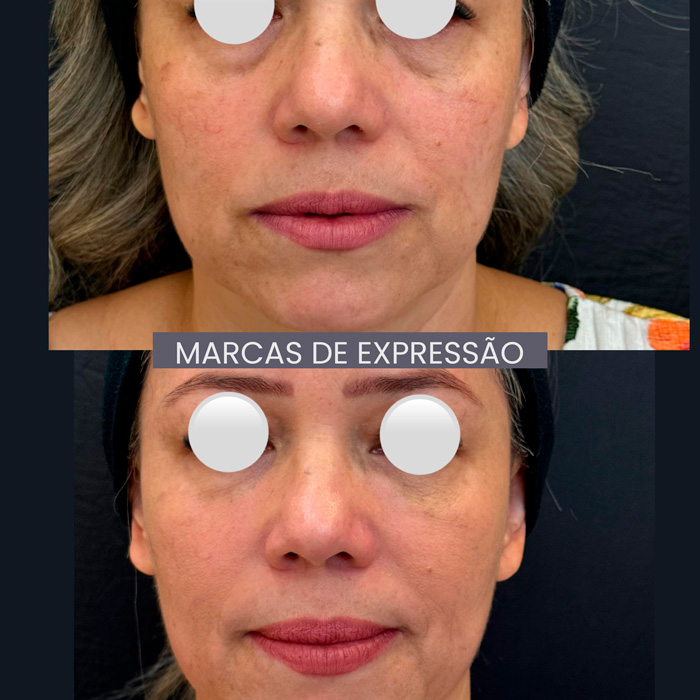dra-gisele-luvizuto-expressao3