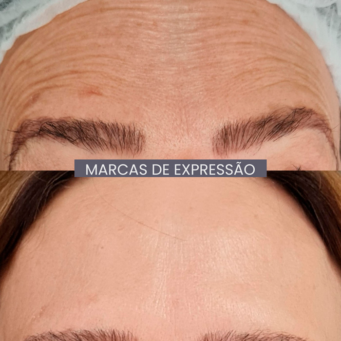 dra-gisele-luvizuto-expressao4