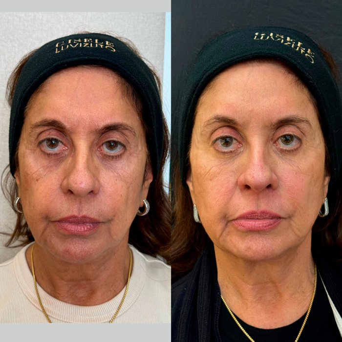 dra-gisele-luvizuto-full-face1