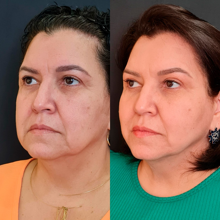 dra-gisele-luvizuto-full-face10