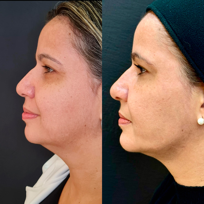 dra-gisele-luvizuto-full-face2