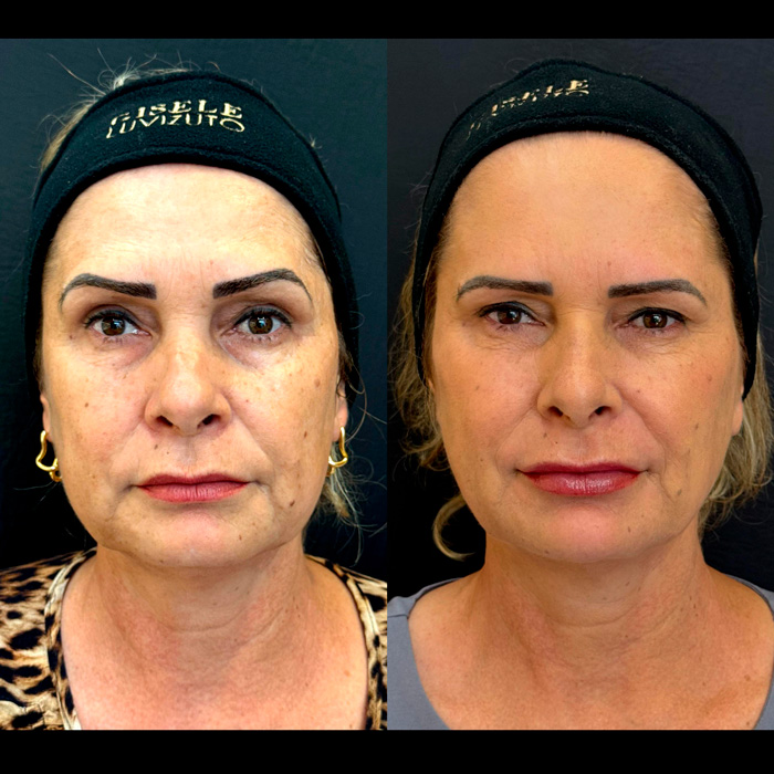 dra-gisele-luvizuto-full-face3