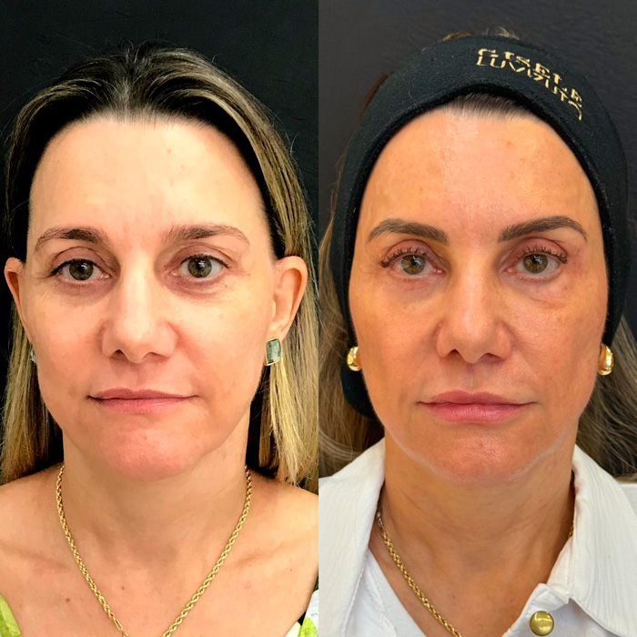 dra-gisele-luvizuto-full-face4