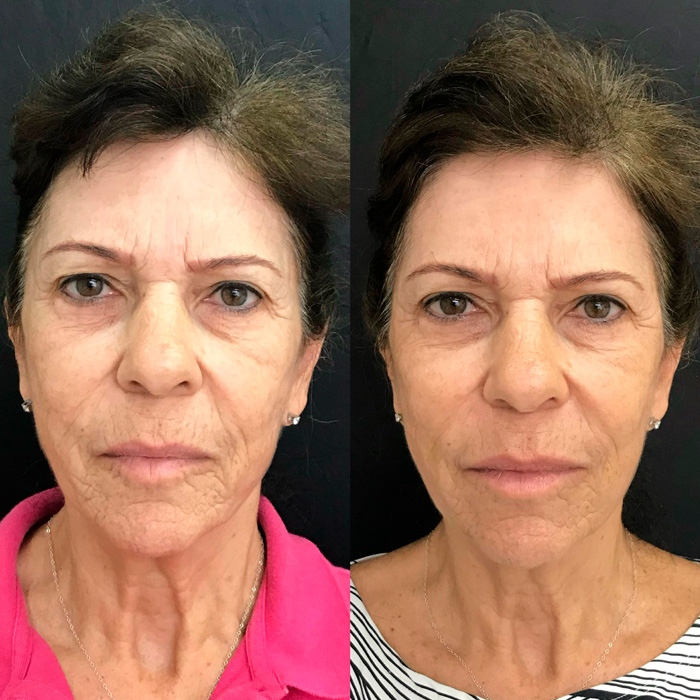 dra-gisele-luvizuto-full-face5