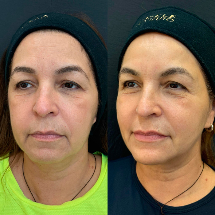 dra-gisele-luvizuto-full-face6