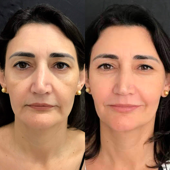 dra-gisele-luvizuto-full-face7