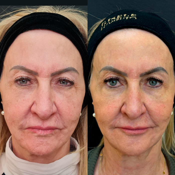 dra-gisele-luvizuto-full-face9